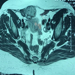 Échographie de la paroi abdominale